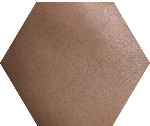 Dull Skin