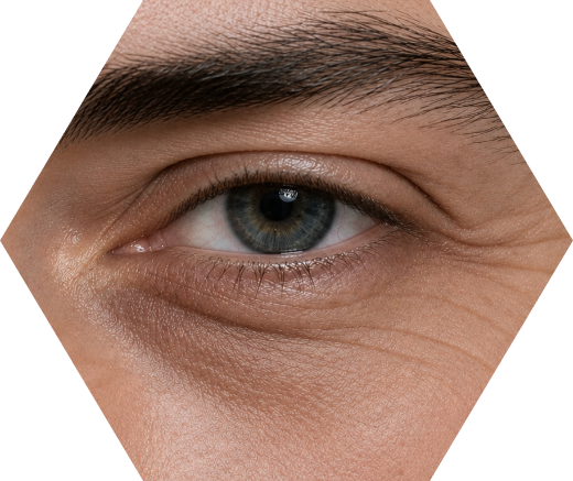 Eye Area Concerns