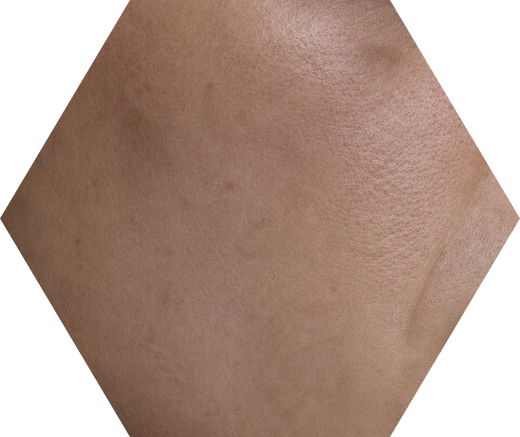 Fatigued / Tired-Looking Skin