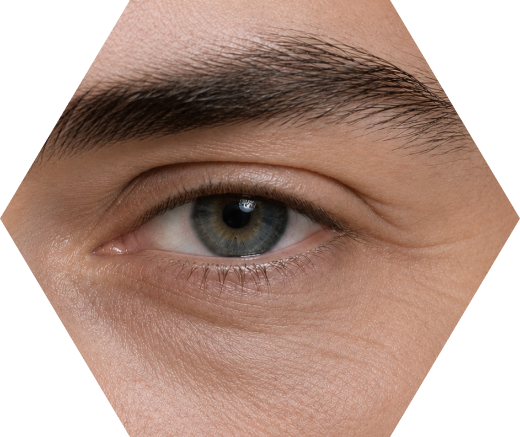 Sagging Skin and Wrinkles